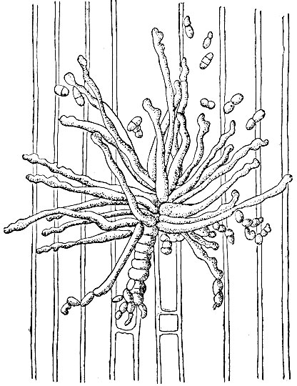 . 4.    Cladosporium herbarum